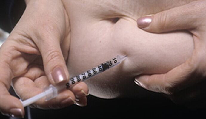 胰島素注射應遵守針頭“一針一換”的原則