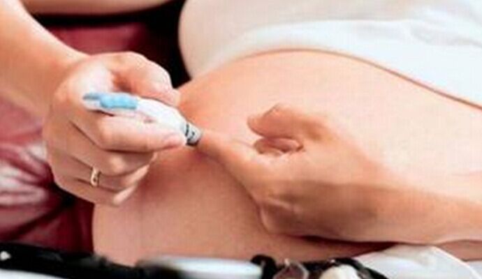 孕後謹防糖尿病  兩步幫你篩查妊娠糖尿病