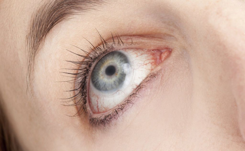 糖尿病眼病的護理措施 糖尿病眼病的原因 糖尿病眼病如何預防