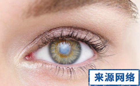 糖尿病並發症有哪些 糖尿病會患青光眼嗎 糖尿病青光眼怎麼治療